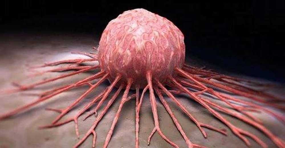 Prof. Dr. Büyükhatipoğlu’ndan kanserden korunma tavsiyeleri  